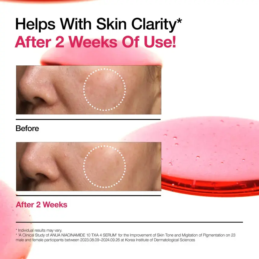 Niacinamide 10% + TXA 4% Serum 10 ml. - Image 5