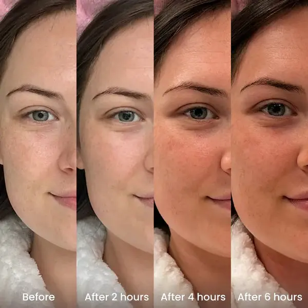 Hyaluronic Acid Tanning Drops - Image 3