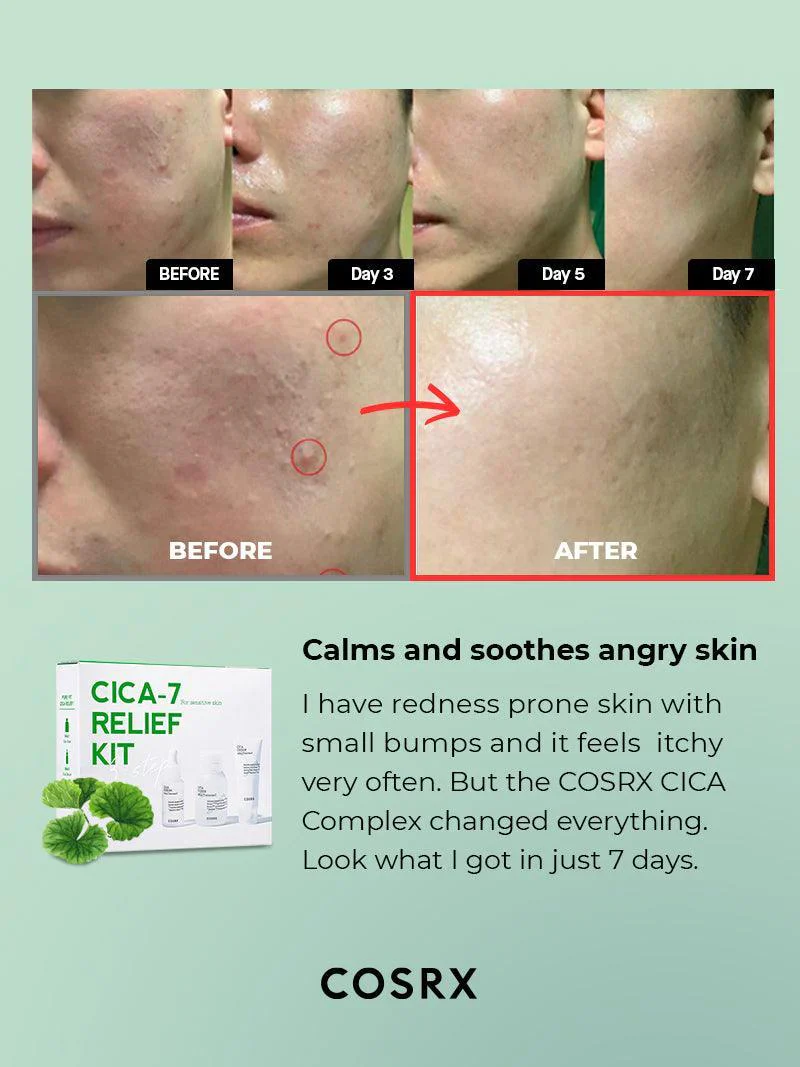 CICA-7 Relief Kit - Image 2
