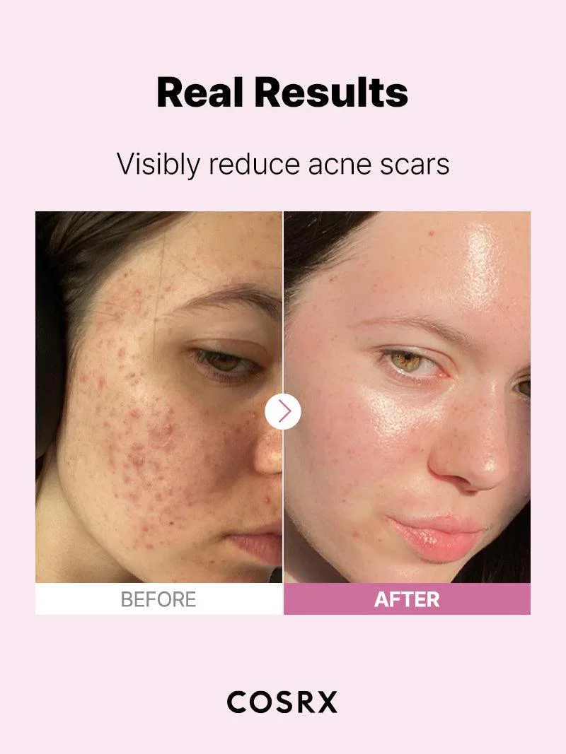 The Niacinamide 15 Serum - Image 9