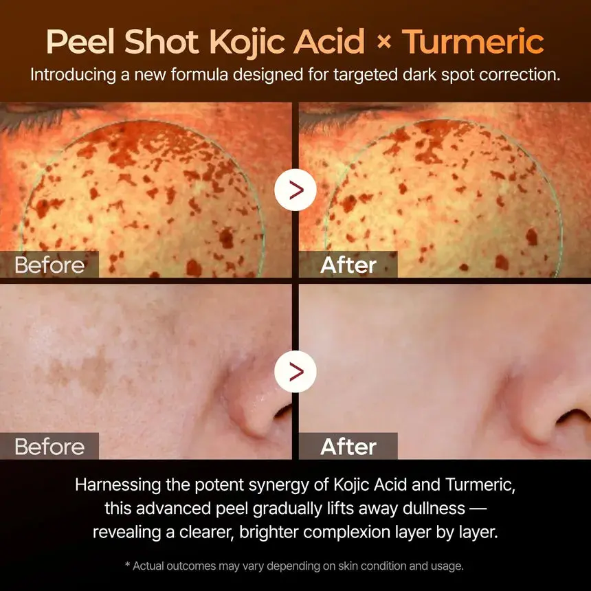 Peel Shot Exfoliating Kojic Acid Turmeric Serum - Image 3