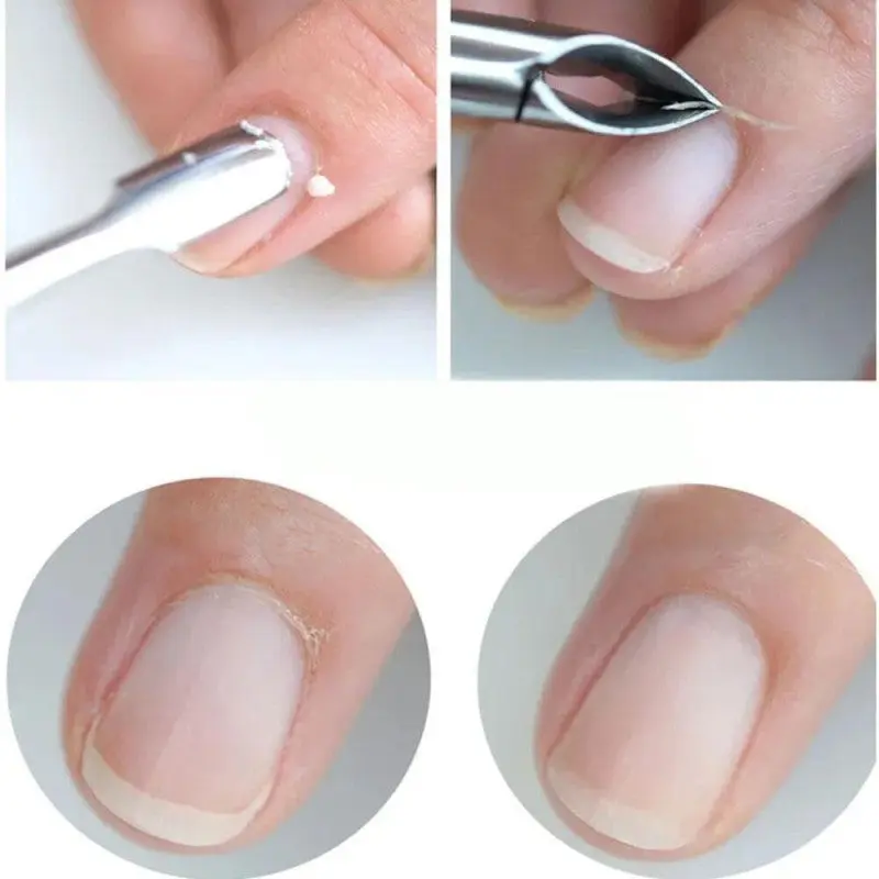 Cuticle Remover - Image 2