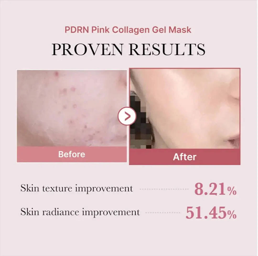 Pdrn Pink Collagen Gel Mask 4-Pack - Image 6