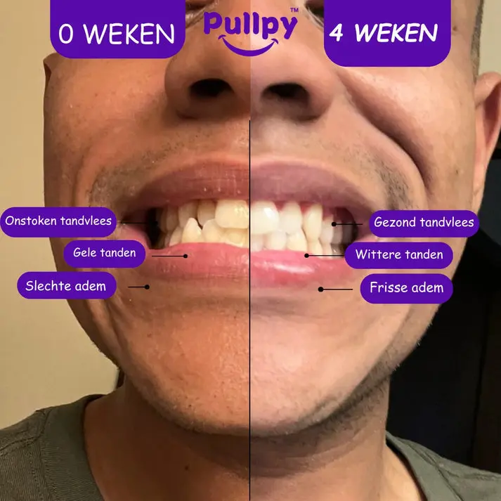Coco Munt Oil Pulling Mondspoeling - Image 2